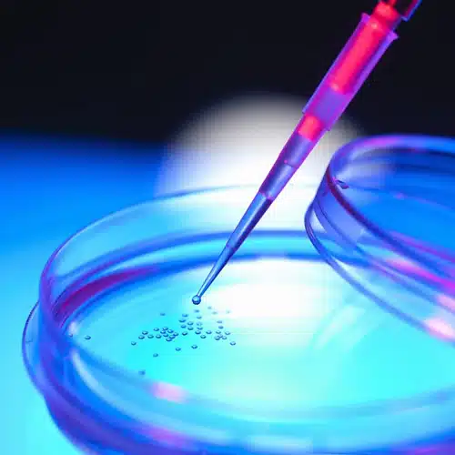 کیت های استخراج